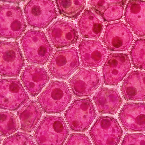 anthocyanins-yellow-rose-charde